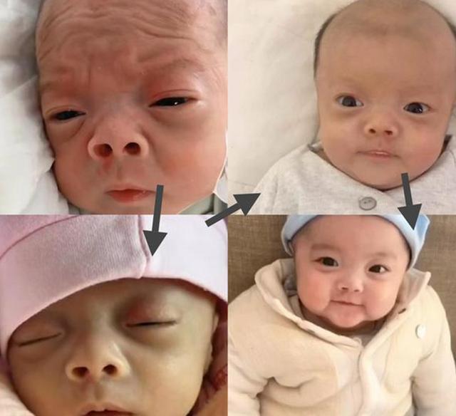 小宝宝|还记得“丑哭宝妈”的网红宝宝吗?当初你嫌我丑,如今美到认不出