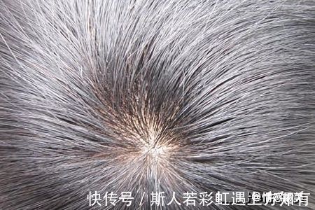 宝宝|宝贝头上的“头旋”个数代表啥？可能很多宝妈还不清楚