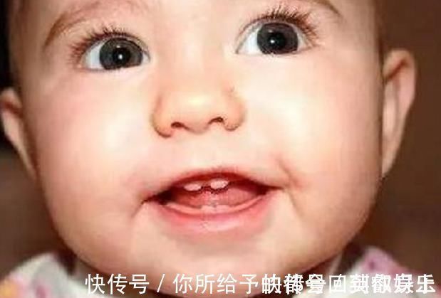 恒牙|6岁男娃长“双层牙”,老人的“坏习惯”害了娃,你家有这习惯吗