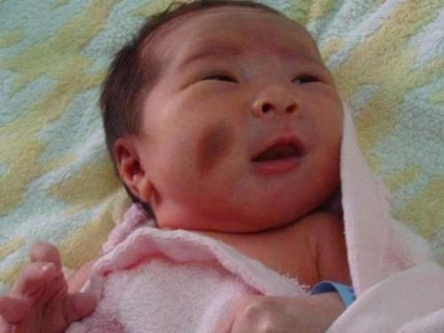 电器|女生怀孕后，4件事最好不做，避免宝宝身上会留下“胎记”