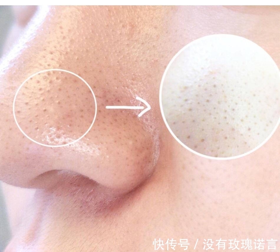 这些清洁面膜如果停产了,我简直世界崩塌!