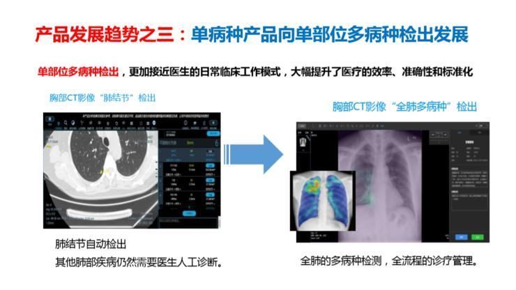 建设|对话长征医院刘士远教授：数据库建设与医学影像AI的未来