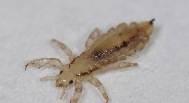 为何30年前农村几乎男女都有虱子,现在怎么没了虱子是哪来的