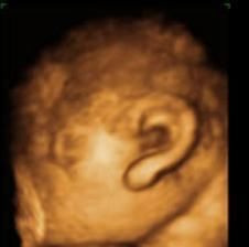 尼克|90后孕妇生下“海豹胎”,曾拒绝医生打掉,如今杂戏团要高价收购