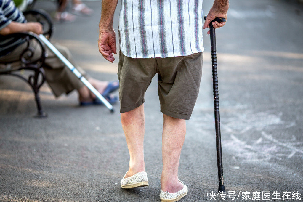 走路姿势|“那人好可爱，走路像企鹅”，这“可爱”背后可能藏疾病，这5种异常步态透露着健康信号