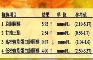 粗粮|这一种粗粮是公认的“降脂冠军”,血脂高的人经常吃,血管通透