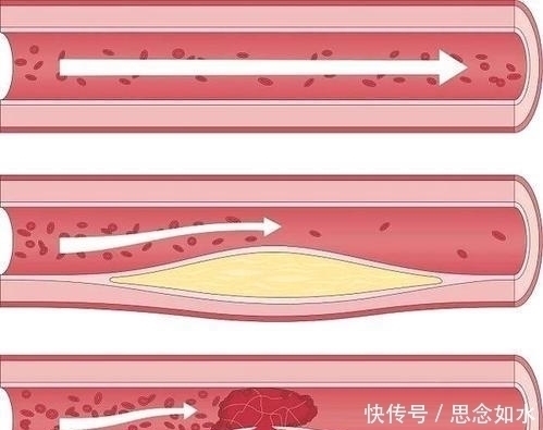 长寿|百岁老人长寿经：不是早睡，也不是运动，而是简单4个字！