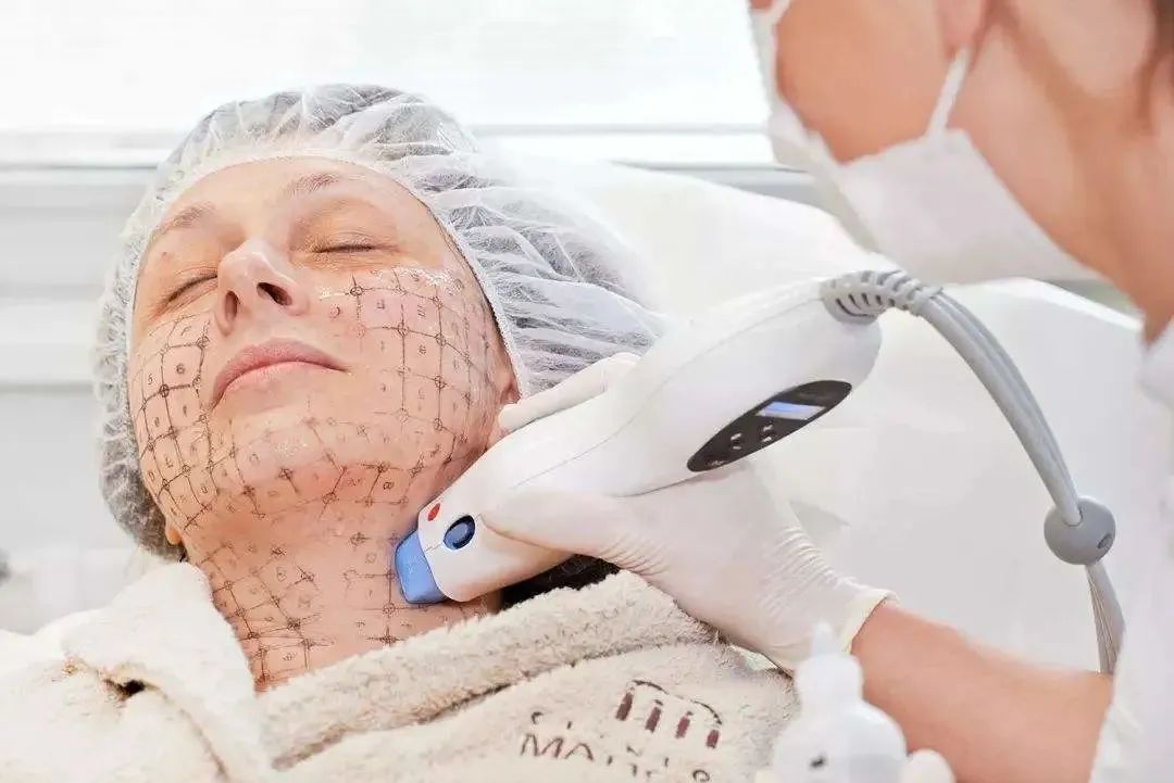 有效率|夏季适合做热玛吉吗?丨科普篇