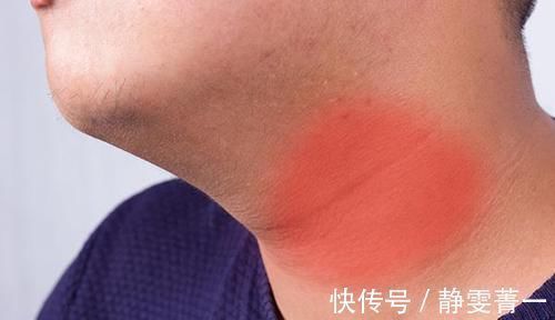 结节|甲状腺患者长结节后,忌讳行为别去做,不然结节越来越多