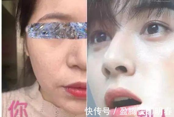 薇娅|能让李佳琦和薇娅看得上,这韩国去角质凝胶,实力真的很强大