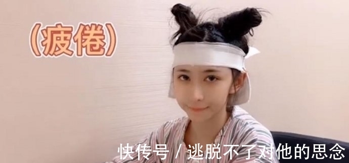 脱发 蔡萝莉真的是一姐?出现秃头危机后,花10多万植发