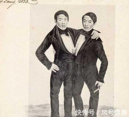 姑娘|连体哥哥爱上英国姑娘,弟弟每次只能回避,姑娘想一招三人都幸福