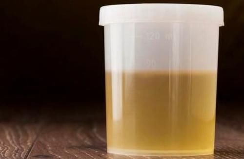 肝脏有问题|肝脏出了问题,常伴有3种“征兆”,发现1个肝脏也能感谢你!