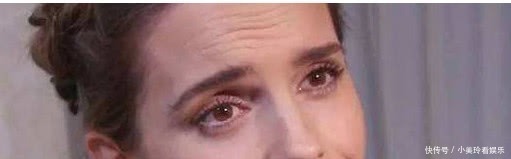 生活习惯|为什么会出现“抬头纹”?主要是这3大原因,别说你还不知道