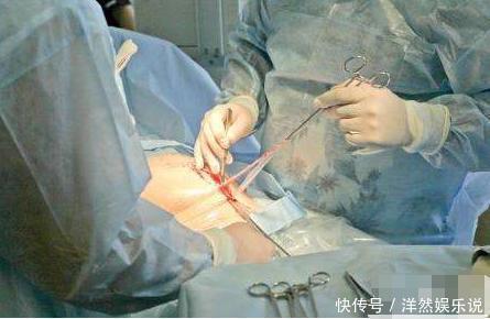 顺产|剖腹产仅划一刀就了事太天真!先看看用的器具,就知道女人多牛