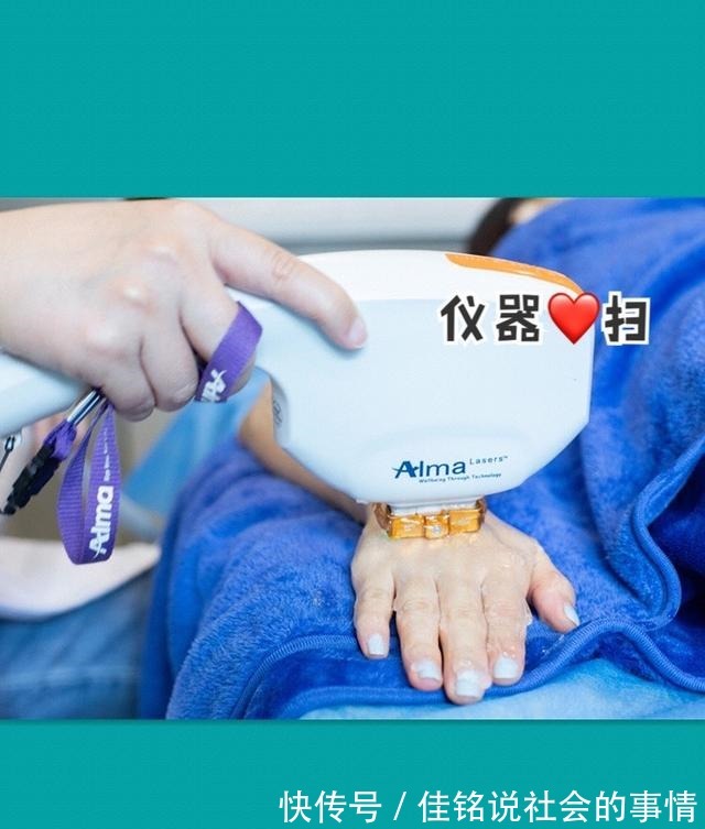 黑金超光子嫩肤 黑金超光子嫩肤真的是无痛的吗!