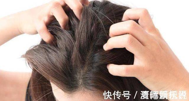 病变|肝脏变硬，头部先知医生头部若有3个表现，或提示该养肝了