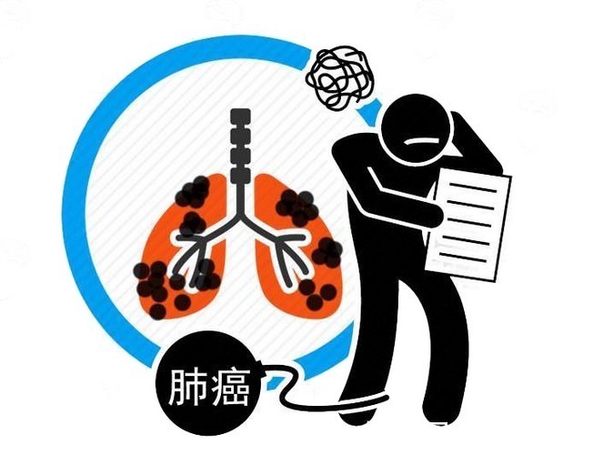 中老年人|年级越大,癌症越易找上门!4种癌症筛查,劝中老年人别错过!