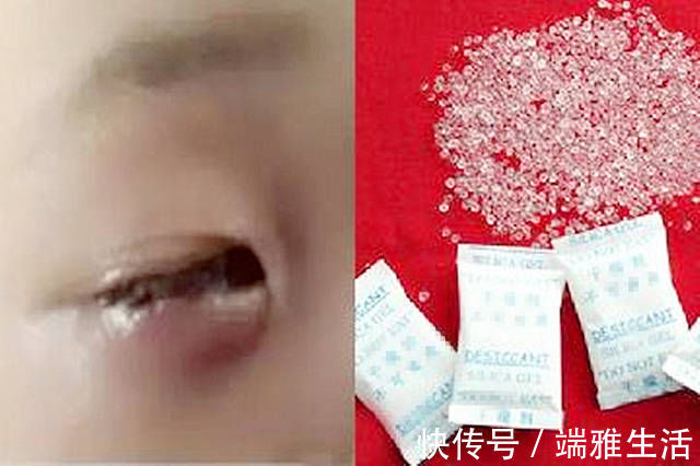 孩子|4岁外孙误食一袋干燥剂,姥姥这个动作救了娃,医生:比我高明