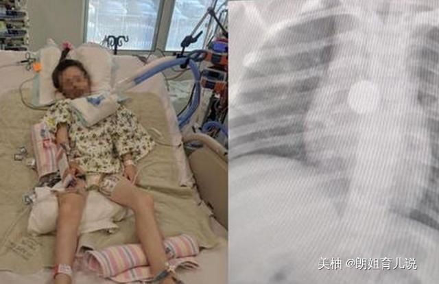 妈妈|5岁女儿暴瘦,医生检查让摘下“项链”,妈妈却说女儿没有戴项链
