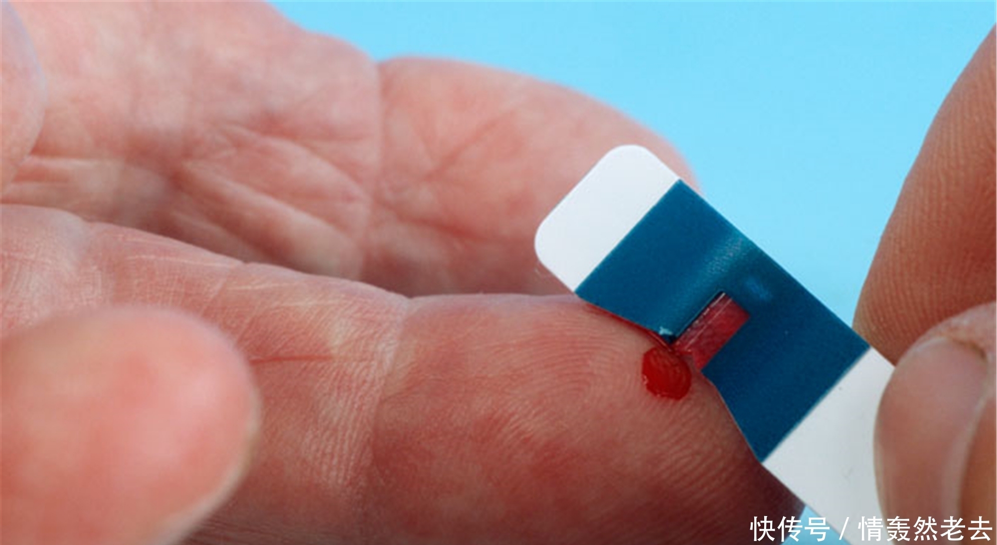 糖尿病是“拖”出来的,身体发出这3种信号,是血糖发出“警告”