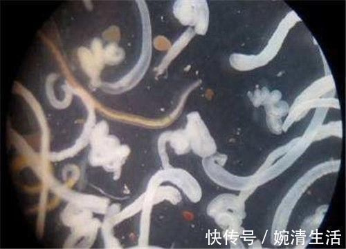 明末@“佛观一钵水,八万四千虫”,没有显微镜,古人如何知道寄生虫的