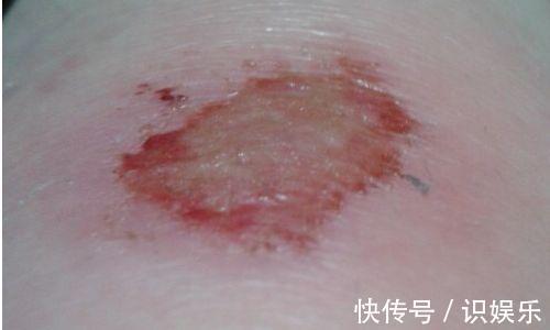 感柒|当身体出现以下五种“特点”,多半是长寿的象征,别以为是坏事