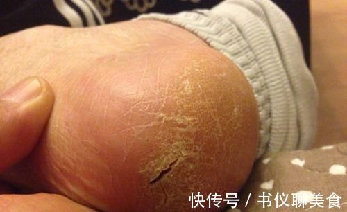 中老年人|橘皮泡脚,越泡越有!老人坚持用橘皮泡脚,10年的烦恼终于解决了