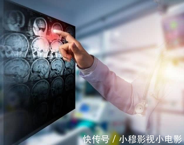 血管堵塞|脑梗塞是吃出来的？劝告：四种食物能不吃就不吃，越吃血管越堵