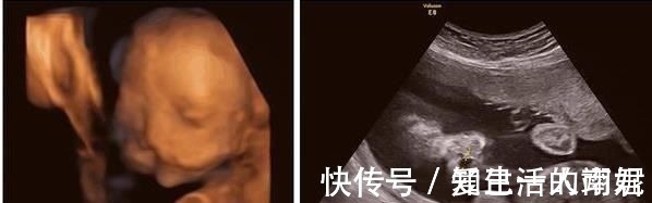 宝妈|妻子怀孕看B超以为双胞胎,欣喜若狂,但孩子出生后,全家乱了套