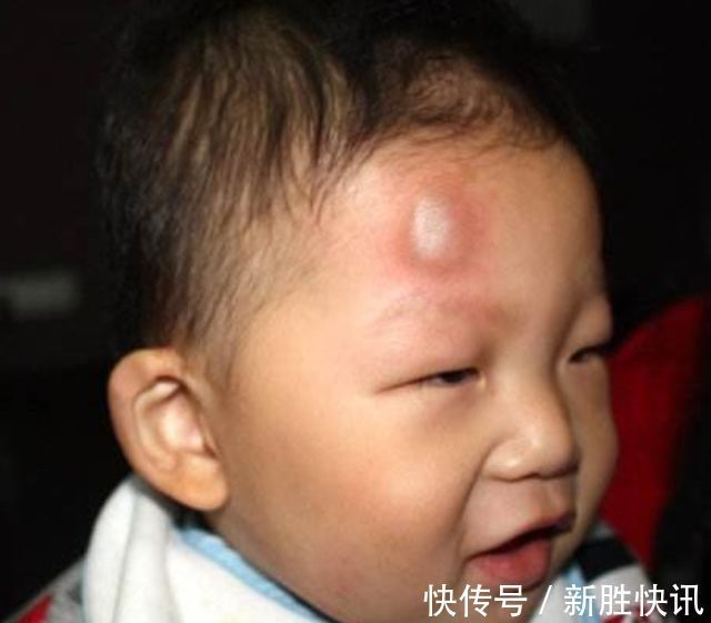 孩子|1岁宝宝摔下床,妈妈的做法让婆婆直呼冷血,医生却说:做的对