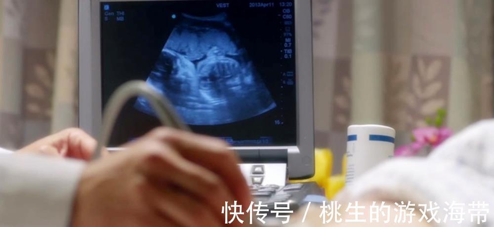 dn孕期要做的众多检查中,一项最贵,一项最难受,还有一项最没用