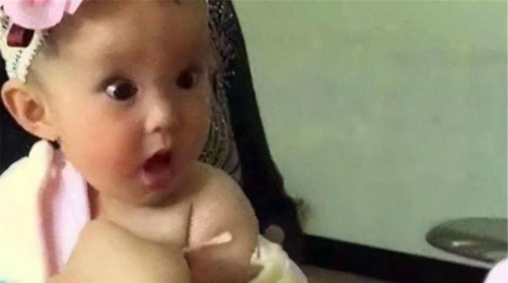 孩子|8个月的宝宝接种疫苗,小表情让人忍俊不禁,医生:舍不得下手