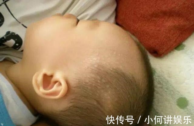 维生素d|孩子一睡觉就出汗,别总以为是缺钙!父母记住3个“关键词”