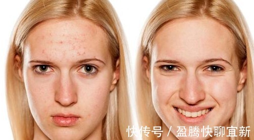 敏感|用了那么多护肤却还是烂脸!皮肤科医生推荐的护肤品闭眼入不会错