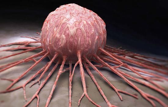 肿块|乳腺癌一发现就是晚期，大夫忠告，身体的三种小病最好及时治疗