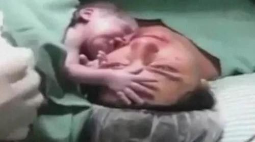 产妇难产心跳停止,婴儿伸手摸妈妈的脸,之后的画面让医生不淡定