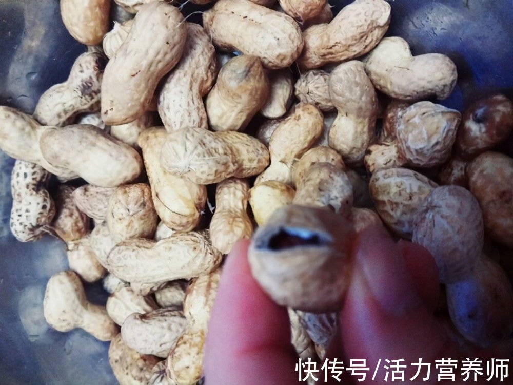 患者|全球肝癌患者多在我国,营养师发出提醒:这几种食物要管住嘴了