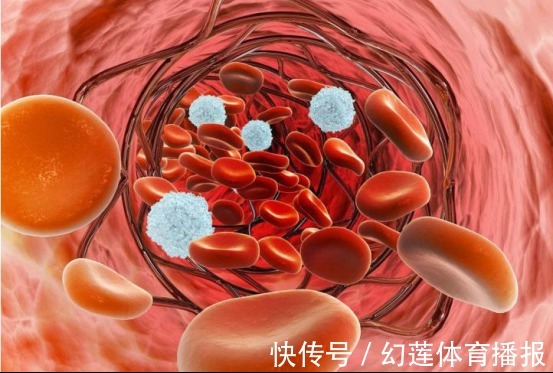 血管|高血脂能否吃花生?退休院士忠告:不想血管堵塞,3物要少吃