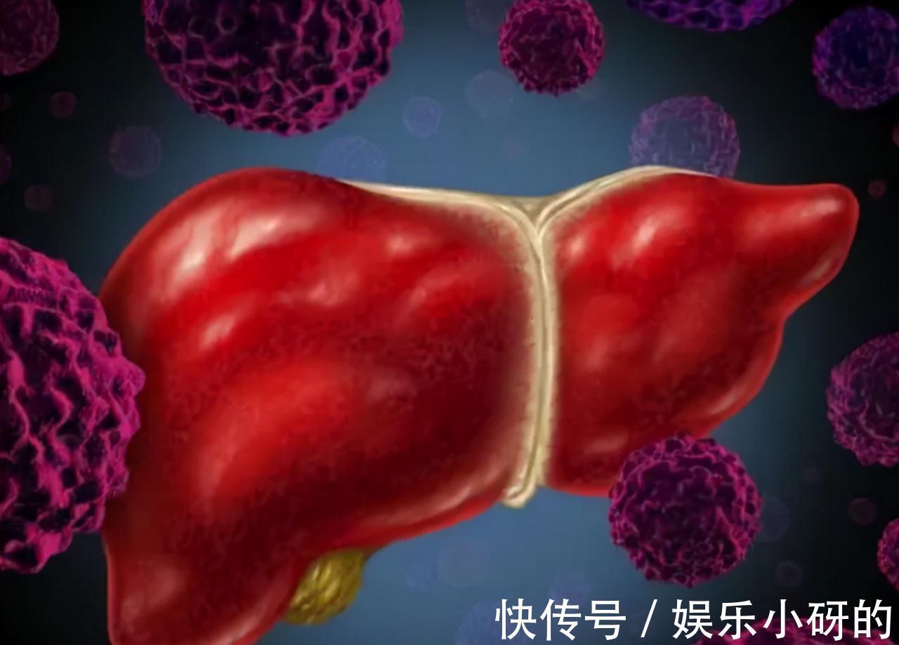 过敏|身体两处“发痒”,别误以为是过敏,有可能是肝病的“报警器”