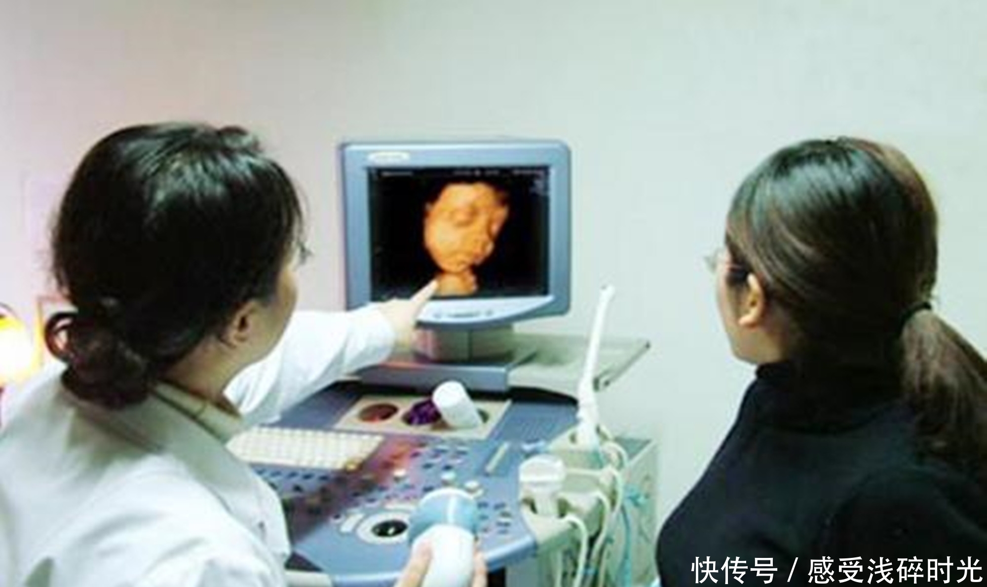 宝宝|宝宝的四维彩超和出生后的模样差异大吗?这种正面照,相似度80%
