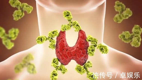 医生|一家五姐妹全部得癌症,一检查还是晚期!医生惋惜,有些钱不能省