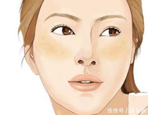 护肤品|淡化痘印应该怎么做?也许这几点都被你忽视了!