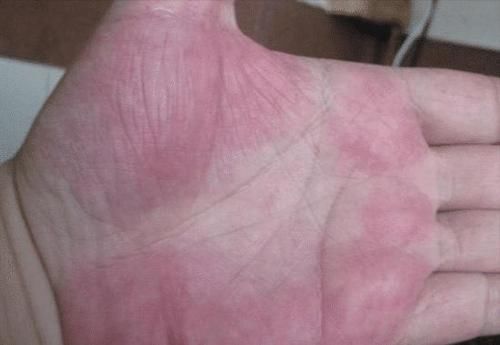 肺脏|养肺就是养命，养肺的好季节已到，医生：这3件事要尽早做