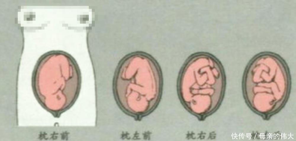 宝宝|怀孕后多久，胎位就要固定了？这个孕周前，孕妈还能“调乾坤”