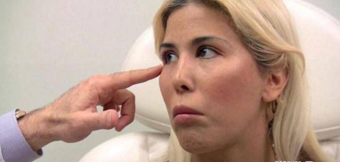 隆鼻 女子花重金整容,一年经历13次整容手术,整容前后判若两人