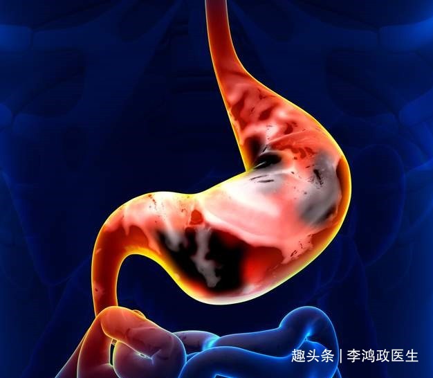 医生|女子头晕半年，以为患癌症，检查结果让她觉得重获新生