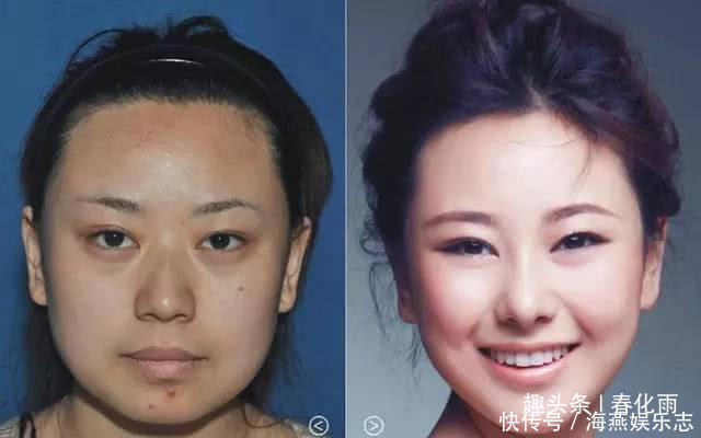 实拍：10张女孩整容前后的对比照，这真就是换了一张脸
