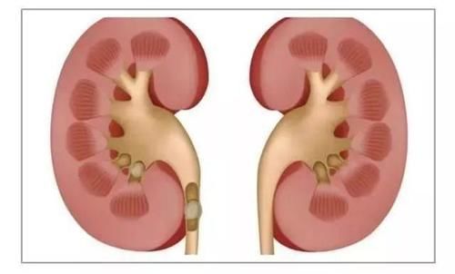 骨关节炎|老年人缺钙后该怎么办?教你3个小妙招,或补钙强肾预防骨关节炎