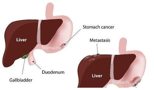 伤害|气能“气”出病来吗？教你按摩三个穴位，帮你解解气，早看早知道